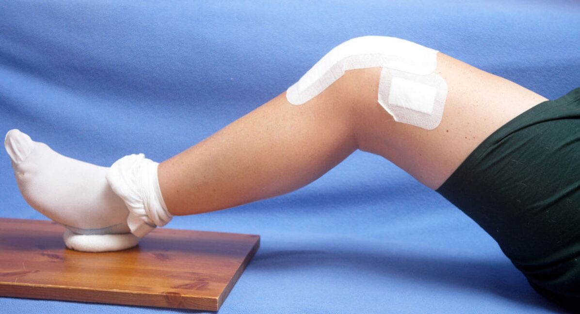 knee injury as a cause of arthrosis