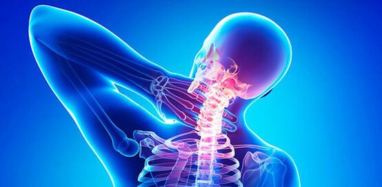 neck pain symptoms