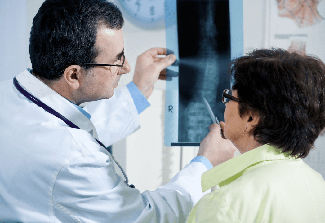 The neurologist diagnoses osteochondrosis using a radiograph of the spine